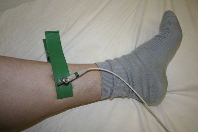 800px-BTL-Elektroda_F_leva_noha