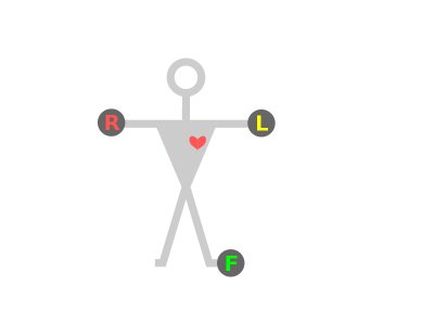800px-ECG-Einthoven-RLF.svg