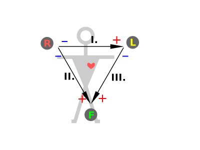 800px-ECG-Einthoven-triangle.svg