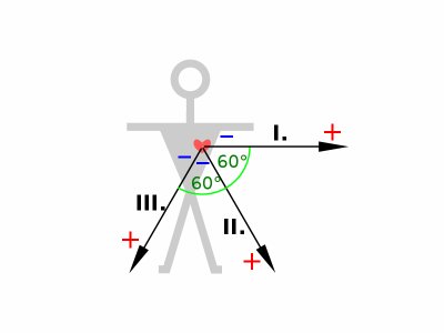 800px-ECG-Einthoven-vect0.svg