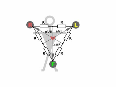 800px-ECG-Goldberger-R.svg