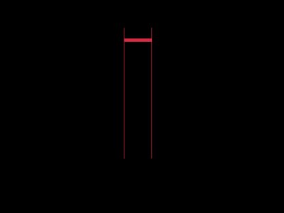 800px-ECG-PQRSkomplexT.svg