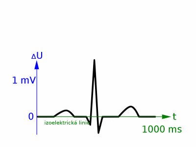 800px-ECG-krivkameritka