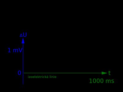 800px-ECG-krivkameritka.svg