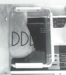 MLO