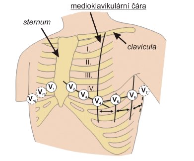 hrudni_elektrody