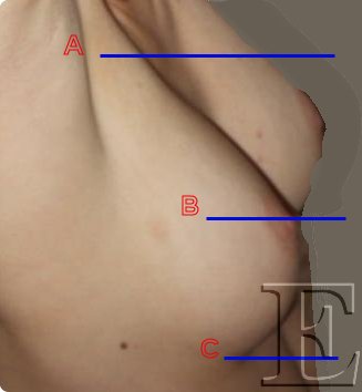 miry1