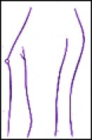 1.gif