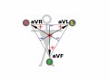 800px-ECG-Goldberger.svg.gif