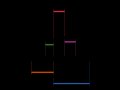 800px-ECG-PQRSTpopis.svg.png