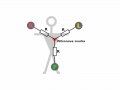 800px-ECG-Wilson-R.svg.gif