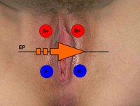 elektrody_gradient_U.jpg