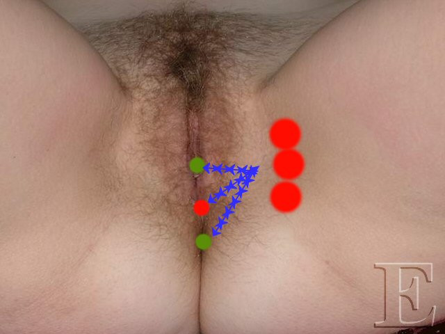 trans_peri_asym