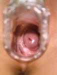 ivet29